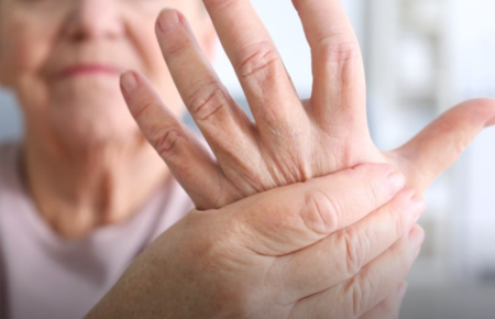 Ревматоїдний артрит є хронічним запальним захворюванням, що переважно вражає суглоби, призводячи до їх болю, набряку та можливої деформації.